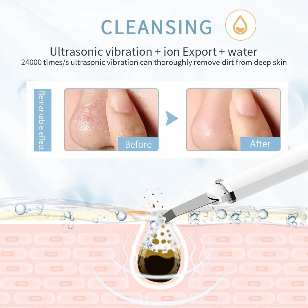 Thermal Care Heat Electric Ultrasonic Facial Scrubber Peeling Shovel Pore Cleaner